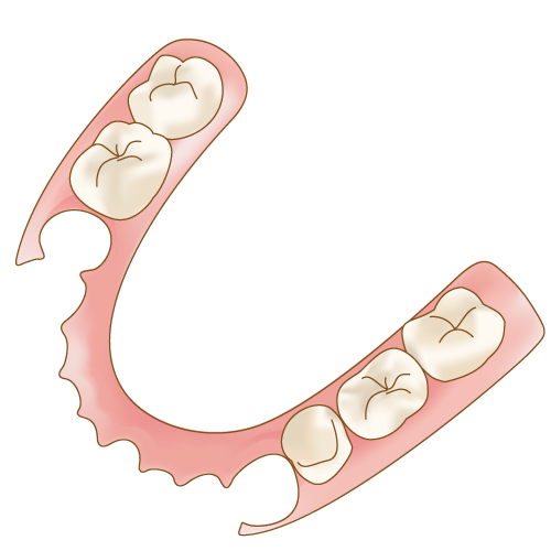 バネのない奥歯の部分入れ歯（ノンクラスプデンチャー）