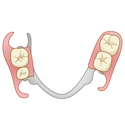 部分入れ歯・下顎