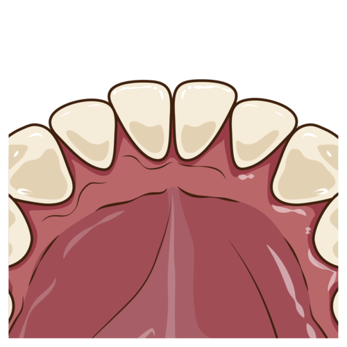 ステイン（着色汚れ）の無い歯