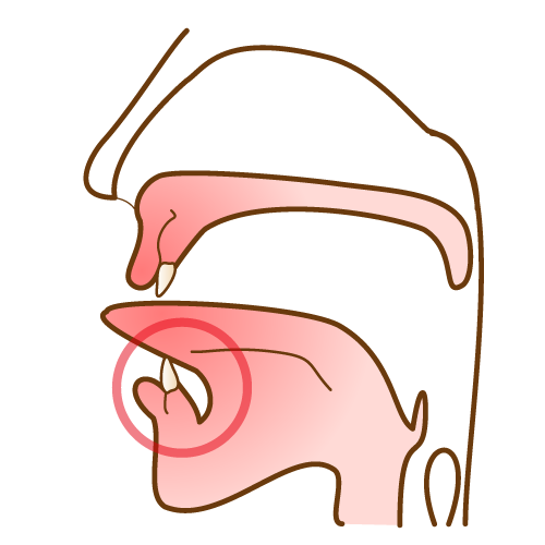 顎断面図 正常な舌小帯 目印