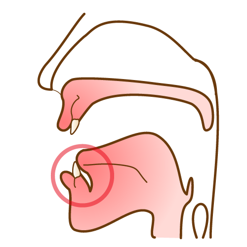 顎断面図 短い舌小帯 目印