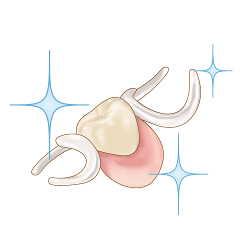 キラキラの白いバネの部分入れ歯