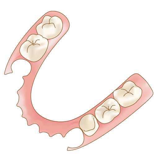 バネのない部分入れ歯 ノンクラスプデンチャー 歯科素材 Com 歯医者さん向け無料イラスト