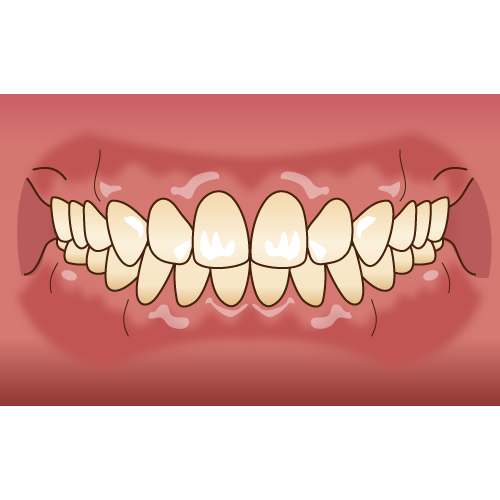 綺麗な永久歯の歯並び