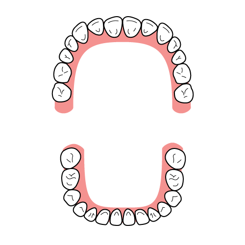 歯列弓の形（方形歯列弓）