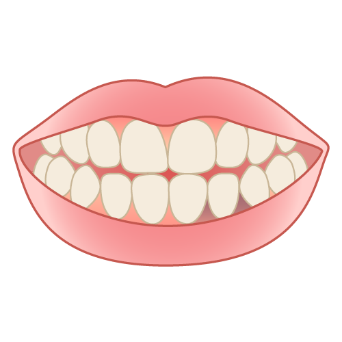 部分的な歯ぐきの変色