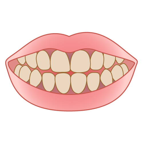 歯と歯ぐきの変色