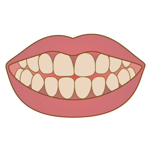 歯と歯ぐきと唇の変色