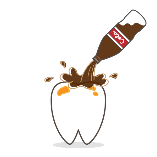 コーラによってエナメル質が溶けた歯 歯科素材 Com 歯医者さん向け無料イラスト コーラによってエナメル質が溶けた歯 歯科素材 Com 歯医者さん向け無料イラスト