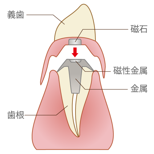 マグネット式（説明付）