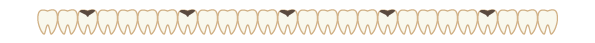 歯の区切り線（むし歯）