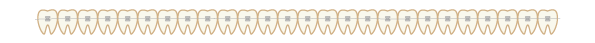 歯の区切り線（ブラケット）