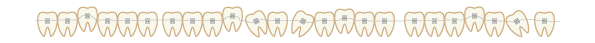 歯の区切り線（矯正）