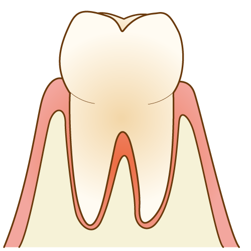 歯周病（健康な状態）