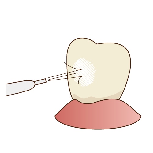 PMTC（研磨）