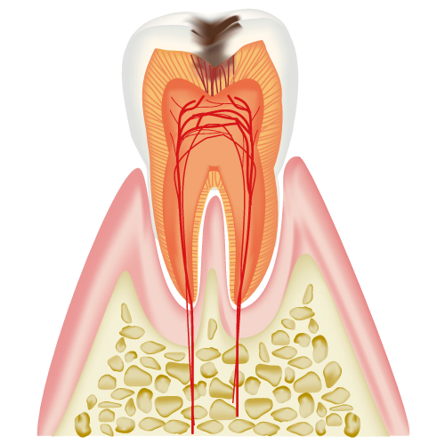 歯の断面（Ｃ２）