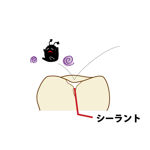 乳歯の断面 イラスト一覧 歯科素材 Com 歯医者さん向け無料イラスト