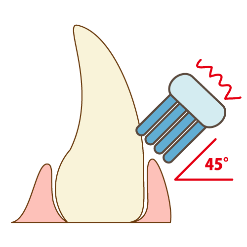 前歯の歯磨き（45度で小刻みに動かす）