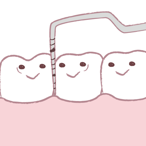 小児歯科 流れ04（歯周ポケットチェック）