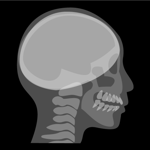 セファロレントゲン（頭蓋骨）