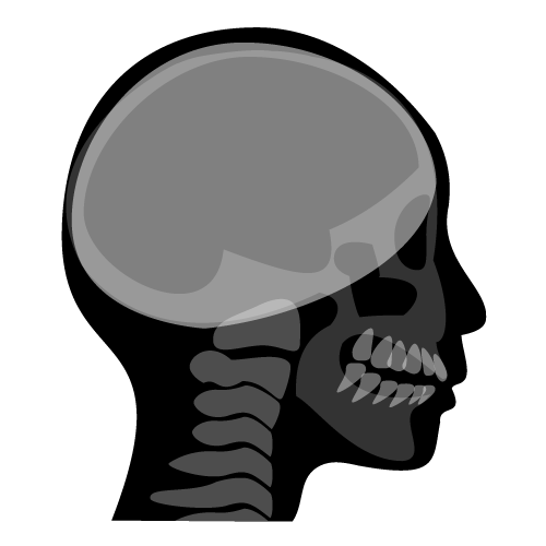 セファロレントゲン（頭蓋骨）背景白