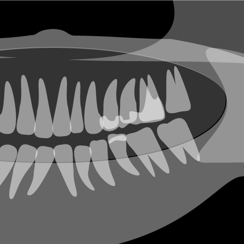 レントゲン（歯科レントゲン）拡大ver.